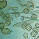 Illustration for article titled Species Of Blue-Green Algae Announces IPO